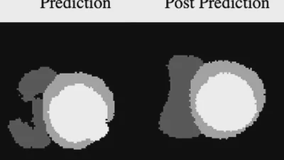 Cardiac Segmentation With Strong Anatomical Guarantees featured image